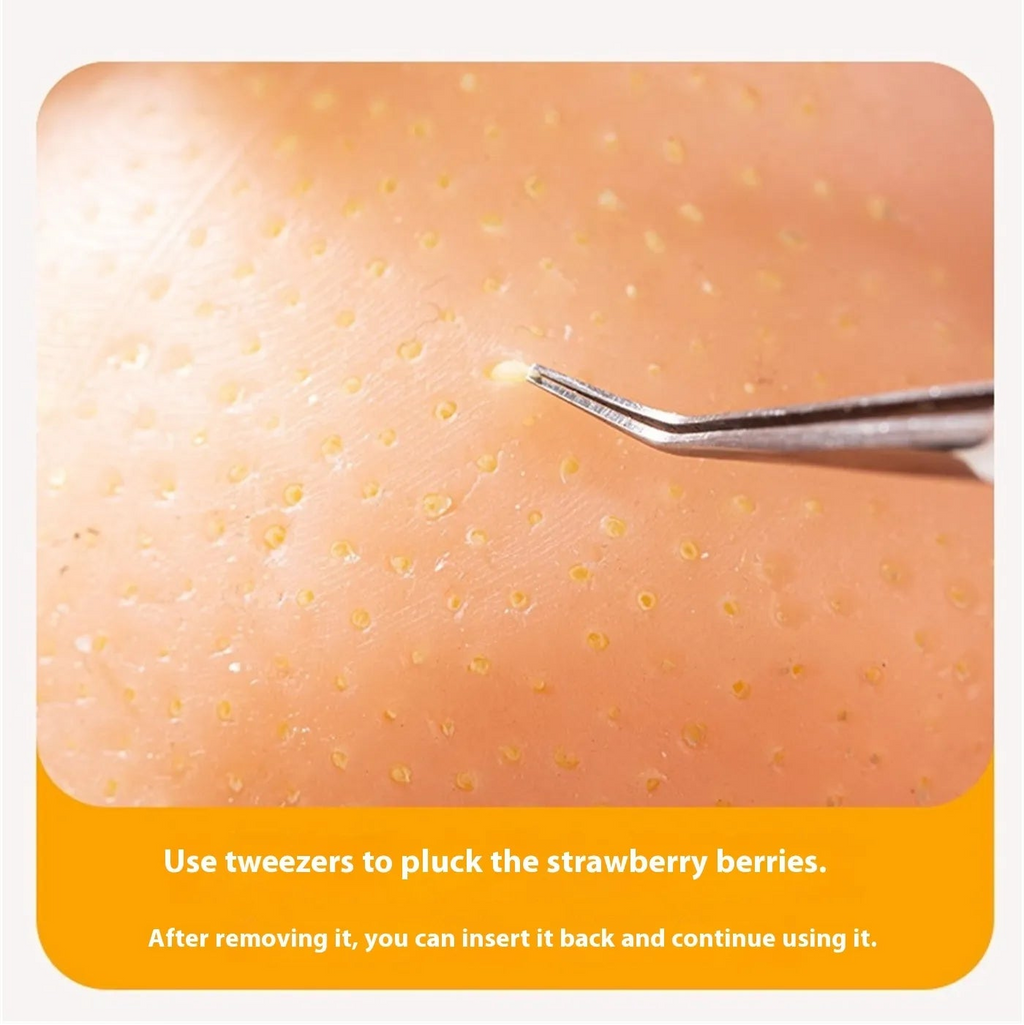 Big Head – The Realistic Acne Popping Stress Toy